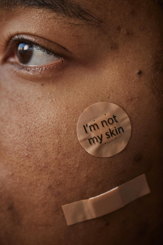 Why Skincare Is More Than Self-Care + How to Start